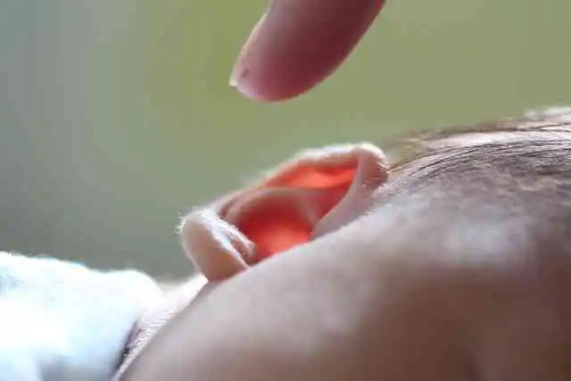 귓볼-피지낭종-치료법005.webp